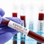Virologista belga propõe um plano para erradicar COVID-19 em 6 semanas usando ivermectina
